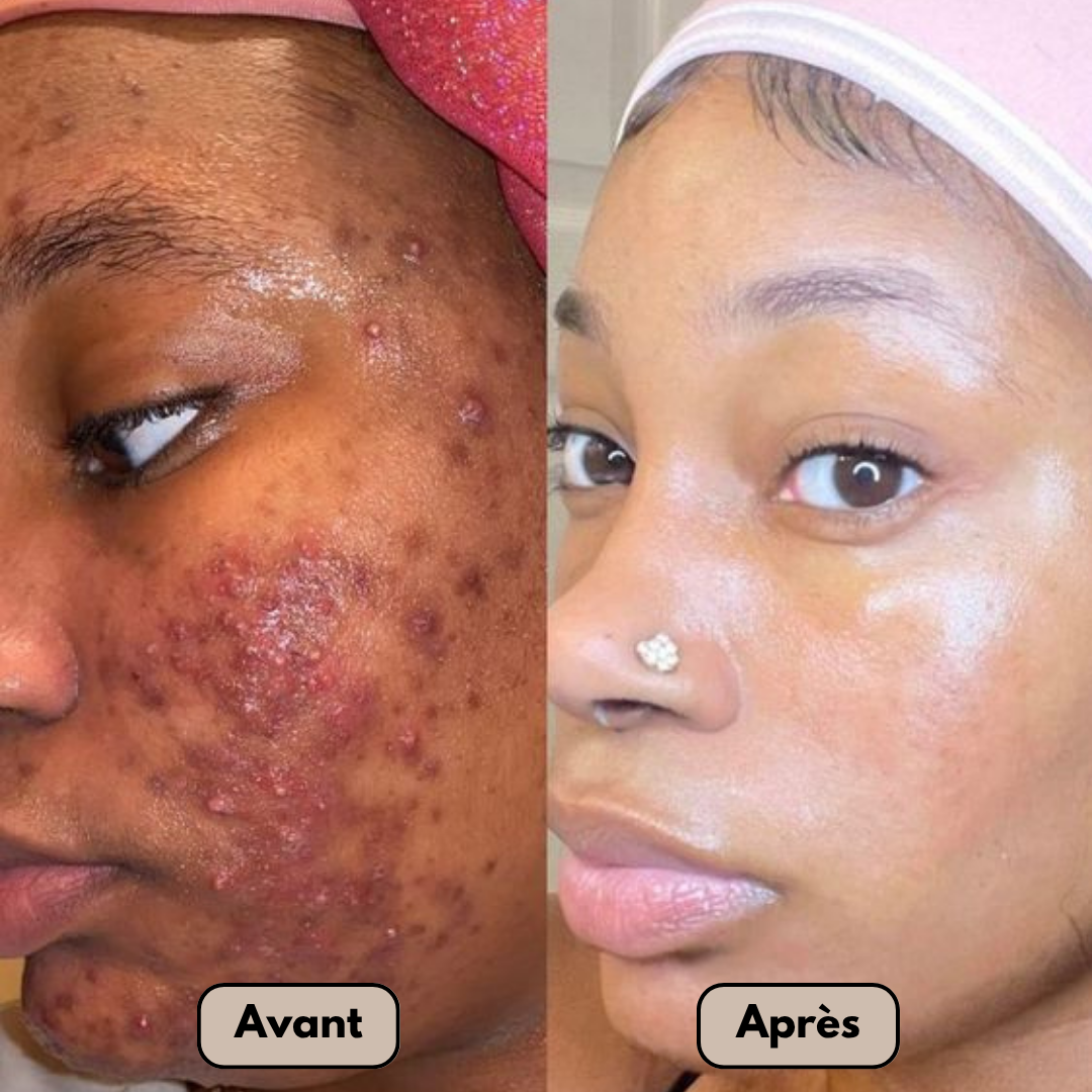 Noraske™ GlowBar – Savon Visage & Corps au Curcuma